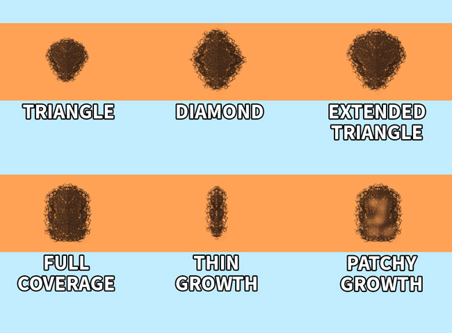 Male Pubic Hair Patterns Trim Shave Or Style Male Pubic Hair Patterns Trim Shave Or Style